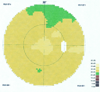 M. C. , 58 ans, Octopus OD