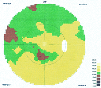 M. D., 50 ans, Octopus OD