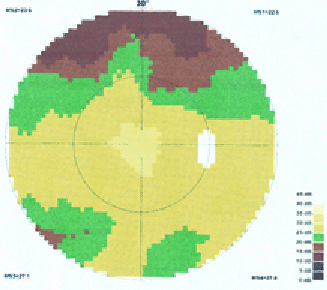 Mme B., 50 ans, Octopus OD