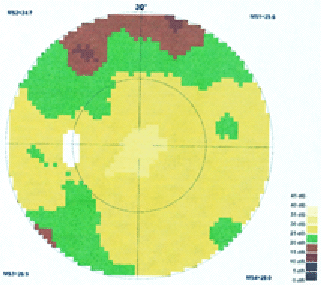 Mme B., 50 ans, Octopus OG