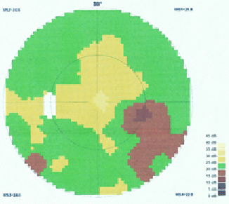 Mme B., 72 ans, Octopus OG