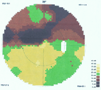 M. C., 66 ans, Octopus OD
